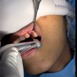 dental surgery